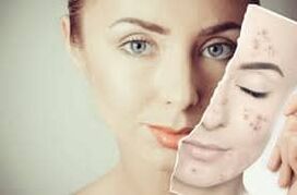 Substitúe Botox