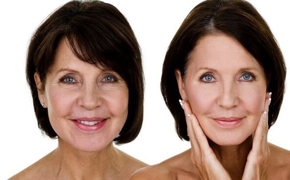 antes e despois do rexuvenecemento da pel facial na casa